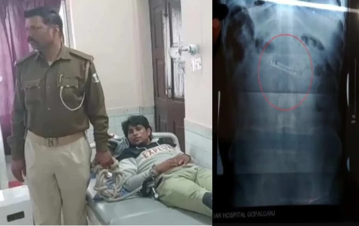 कैदी के पेट से निकला मोबाइल