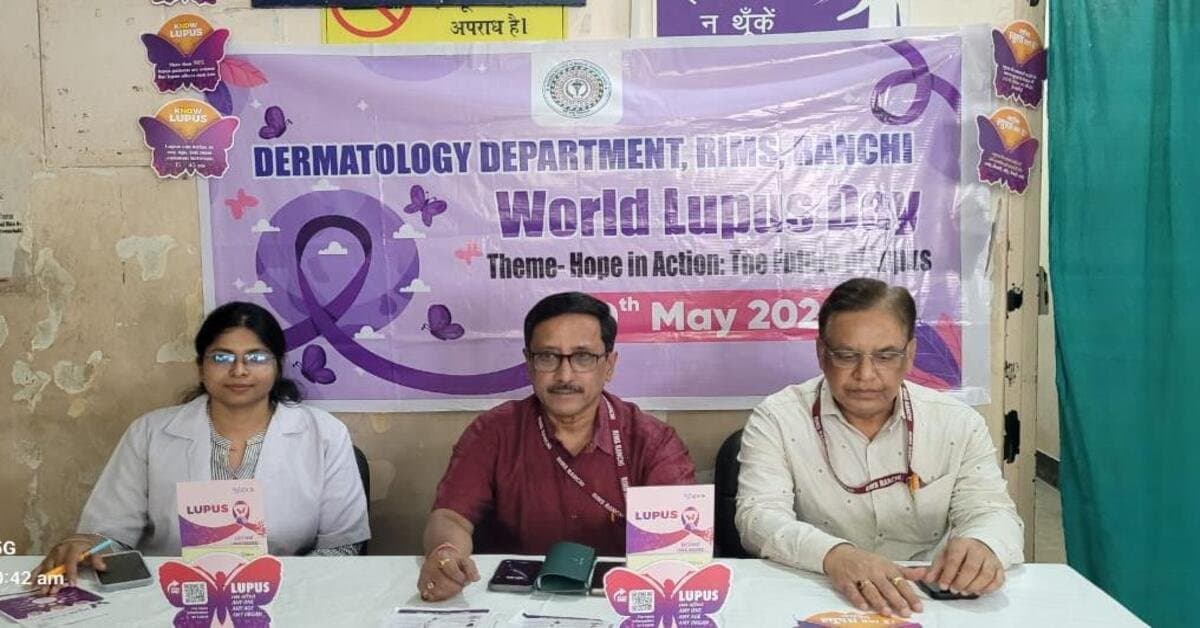 रांची समाचार: ऐसे लक्षण दिखें तो रहें सतर्क, लूपस आपकी सेहत को न बिगाड़ दे।