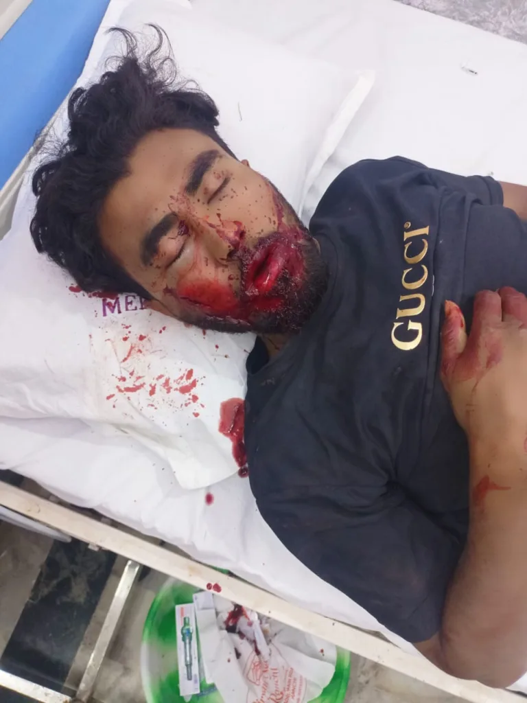 बेकसूर पिता बेटे और बेटे के दोस्त को चाकू से किया हमला तीनों की हालत गंभीर रिम्स भी ईलाज चल रहा 6 WhatsApp Image 2023 03 05 at 4.04.25 PM