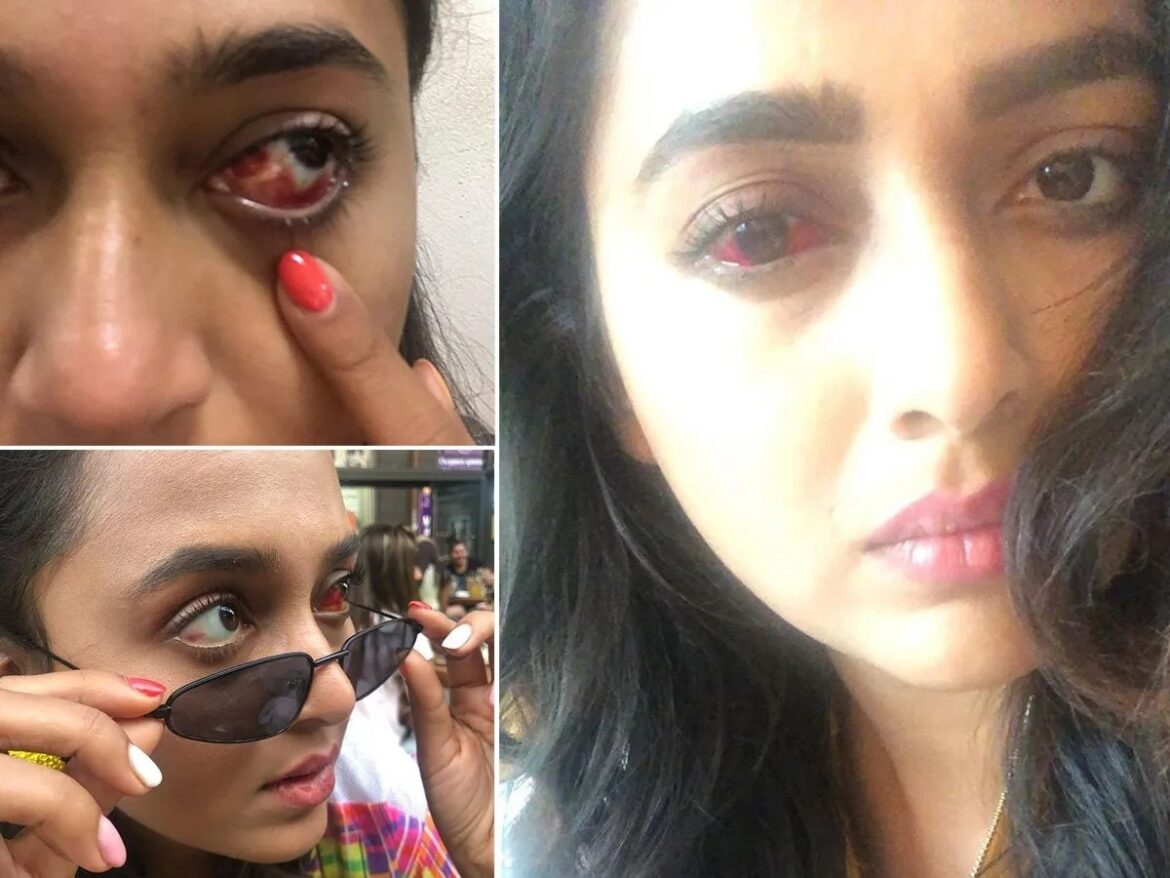 Tejasswi Prakash का हुआ था भयानक एक्सीडेंट, स्टंट करते समय